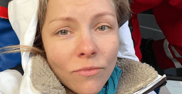 Хореограф Олена Шоптенко перенесла складну операцію (фото)