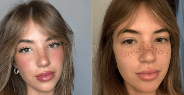 Девушка сделала тату веснушек: люди говорят, что она испортила лицо (фото)