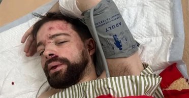 Скандал з лаборантом із Львівського університету: чи дійсно його побили представники ТЦК