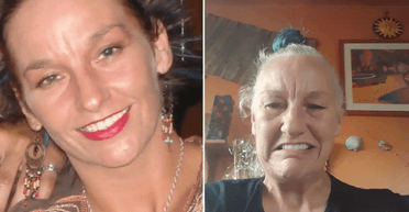 Жінка віддала всі гроші на нові зуби й "постаріла на 20 років" за один день (фото)