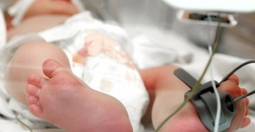 "Самый молодой пациент в литературе": впервые в Украине младенцу провели уникальную операцию (видео)