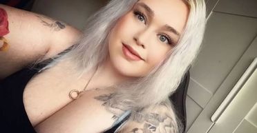 У Данії жінка лягла в лікарню, адже її шкіра різко посиніла: причина здивувала лікарів (фото)