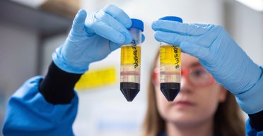 Вакцина от коронавируса может быть разной, в зависимости от возраста, - ученые