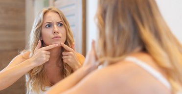 Идеальная кожа: 6 советов, как избавиться от черных точек на лице