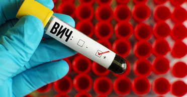 У меня ВИЧ, и значит, я живу. 4 истории людей с диагнозом