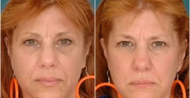 Вчені порівняли зовнішність двох близнючок з різними долями: результат вражає (фото)