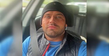 Похож на "Мегамозг": британец шокировал коллег отеком после окрашивания волос (фото)