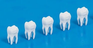 Заміна пломбам та імплантам: новий матеріал допомагає створити справжні зуби в лабораторії