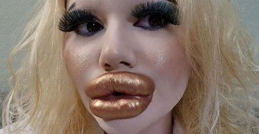 Душа требует перемен: женщина с самыми большими губами в мире нацелилась на новый рекорд (фото)