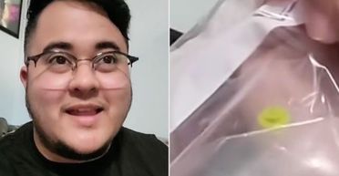 Чоловік прожив 26 років з шматком конструктора в носі: тепер у нього унікальний нюх (фото)