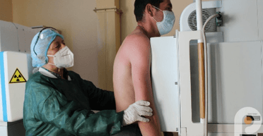 Россияне заставляют жителей оккупированных территорий делать флюорографию: зачем это РФ