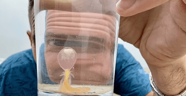 Схожі на очне яблуко: на берег винесло десятки небезпечних "спагеті-монстрів" (фото)