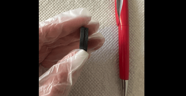 Во Львове врачи достали из желудка 7-летней девочки два магнита (фото)