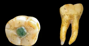 Не только ради красоты: зачем мая вставляли драгоценные камни в зубы (фото)