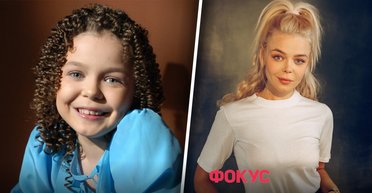 "Співачка використовує ботокс": фахівець розповів, які пластичні операції робила Аліна Гросу