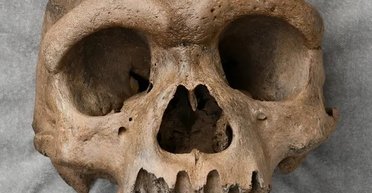 Были удивительно успешными: неолитические люди часто выживали после рискованных операций