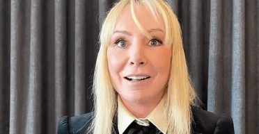 Женщина отдала более миллиона гривен за пластическую операцию: что сделали с ее лицом (фото)