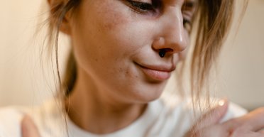 Як зупинити кров з носа вдома?