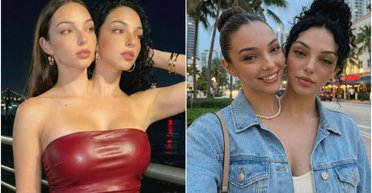 Дві голови, одне тіло: як "живуть" сіамські близнючки з модельною зовнішністю (фото)