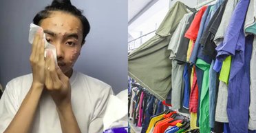 Вирішив заощадити і пошкодував: чоловік показав наслідки покупки в секонд-хенді