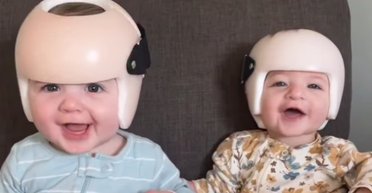 Близнецы проводят в шлемах 23 часа в сутки: мама все объяснила (видео)
