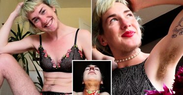 Женщина, которая 17 лет боролась с волосатостью, внезапно отрастила бороду (фото)