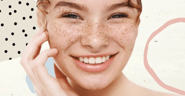 Як позбутися веснянок у домашніх умовах: 5 безпечних способів