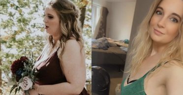 Випадкове відео змінило життя: жінка дізналася про рідкісний діагноз через Facebook