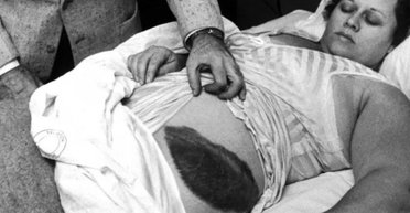 Ця жінка єдина у світі, в яку влучив метеорит, і вона вижила (фото)