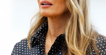 Нове обличчя: пластичні хірурги розповіли, що змінилося в зовнішності Меланії Трамп