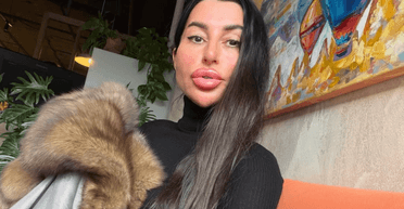 "Похоже на утюг": украинка напугала людей своим "квадратным" лицом (видео)