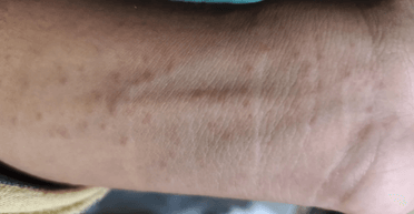 Цяточки на зап'ясті: чоловік не міг повірити, чому вони насправді з'являються (фото)
