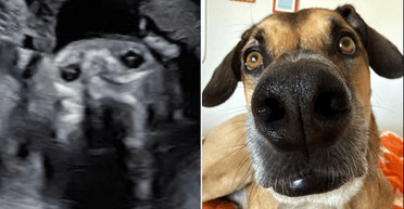 Майбутня мама розсміялася після УЗД: дитина виявилася схожою на їхнього собаку (фото)