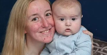 "Ніколи такого не бачили": новонароджений малюк-богатир вразив акушерок (фото)