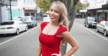 Все тіло в опіках: одну з найкрасивіших жінок світу тепер не впізнати (фото)