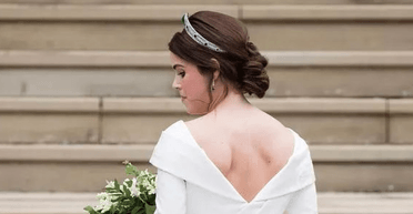 Принцеса Євгенія показала свій шрам на спині (фото)