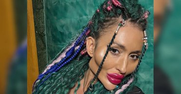 Украинка с "самыми большими в мире щеками" решилась на новую необычную процедуру (фото)