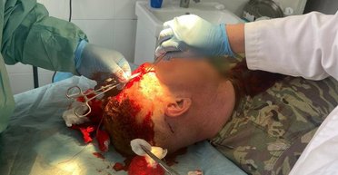 "Жбурляли каміння та цеглини": на Закарпатті місцеві напали на прикордонників (фото)