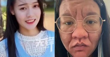 Обличчя змінилося, ніс збільшився: реальні фото жінки до і після пологів