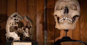 Ученые рассказали, что происходит с зубами после смерти человека