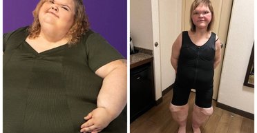 Дівчина, яка схудла на 220 кг, показала оновлену фігуру (відео)