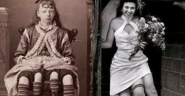Дівчина з 4 ногами, колись показана в цирку, підкорила шоу-бізнес: скільки вона заробила