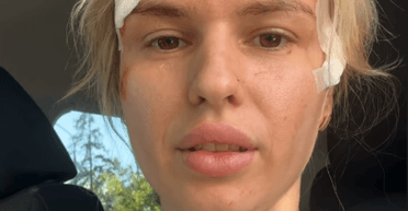 В Кривом Роге мародеры ограбили квартиру пострадавшей от обстрела женщины (фото)