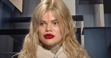 Туберкульоз, гепатит С та ВІЛ: медикиня розповіла, як Україна рятує окупантам на полі бою (відео)