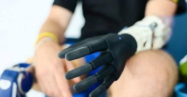 По меньшей мере 25 000 украинцев потеряли конечности из-за вторжения РФ, — Sky News