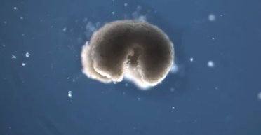 Ні живий, ні мертвий: знайдено третій стан між життям і смертю