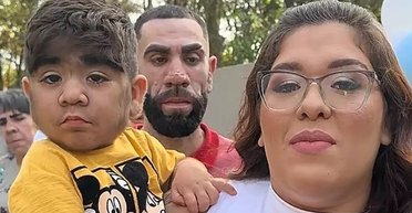 Самый волосатый ребенок в мире станет братом: в соцсетях спорят, насколько "лохматым" будет малыш