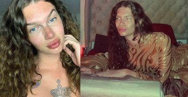 Жінка витратила $8 тисяч, щоб виглядати як кішка, але тепер шкодує про це (фото)