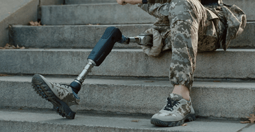 "Зазвичай було за три роки": у Мінсоцполітики анонсували швидке протезування бійців коштом держави