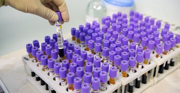 Гени становлять лише 2% нашого ДНК: учені не зовсім розуміють, що роблять інші 98%